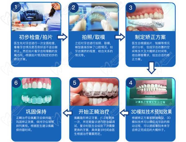 上海亿大口腔牙齿矫正流程