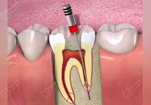 牙体牙髓诊疗