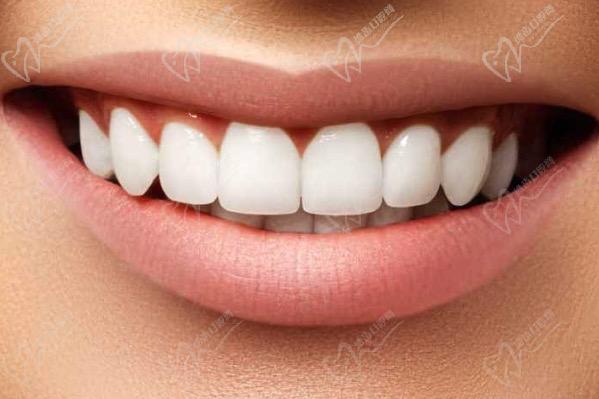氟斑牙是什么原因造成的？