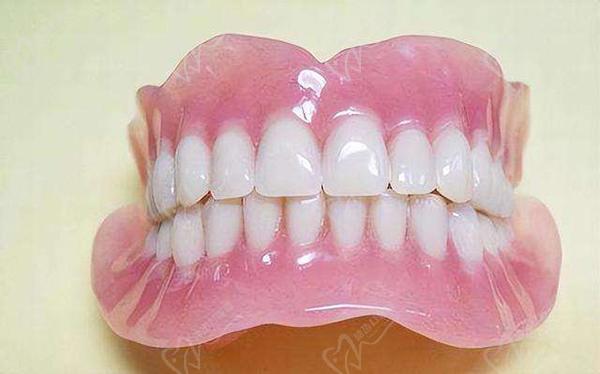 全口戴假牙是一种传统的牙齿修复方法
