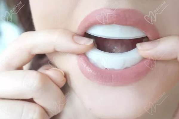 什么是活性牙模美白
