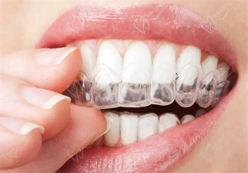 杭州萧山牙科医院牙齿矫治哪个医生好？