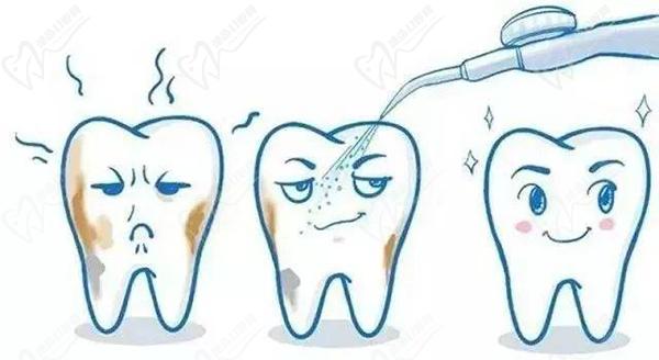 洗牙正确操作流程