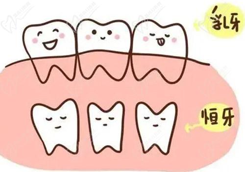 乳牙根管治疗会影响恒牙吗