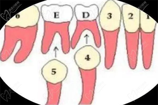 乳牙跟和恒牙根根管数不同