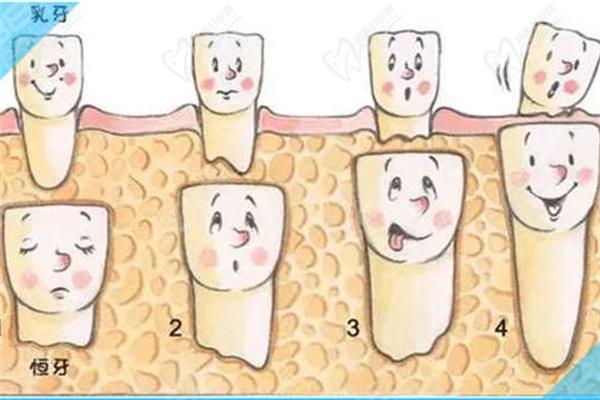 乳牙根与恒牙根的不同