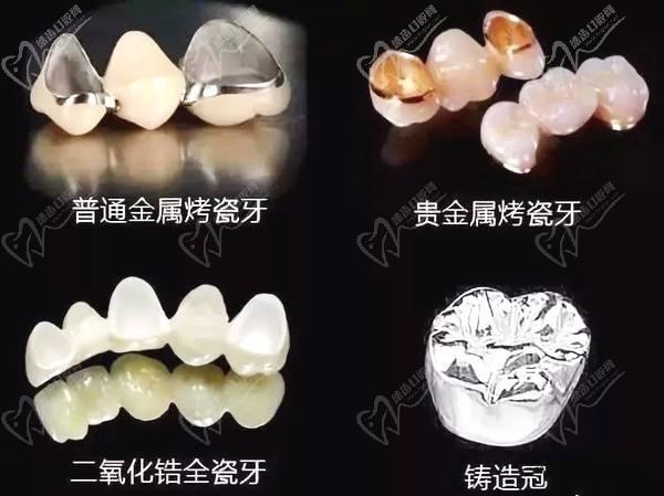 常德美奥口腔钜惠看牙,韩国登腾种植牙3980元起,自锁托槽矫正享5折优惠！