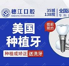 广州穗江口腔美国种植牙仅需3920元起，种植流程规范含牙冠
