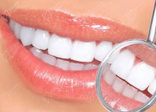来看扬州贝恩口腔牙齿矫正价格-6800元就能做性价比高选择多